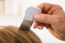 how to get rid of nits